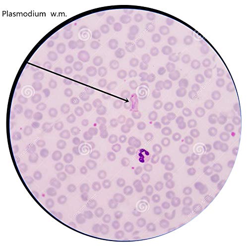 Prepared Protozoa Microscope Slides for Biology Science Education, Pack of 5pcs Specimens by DIY-SCIENCE