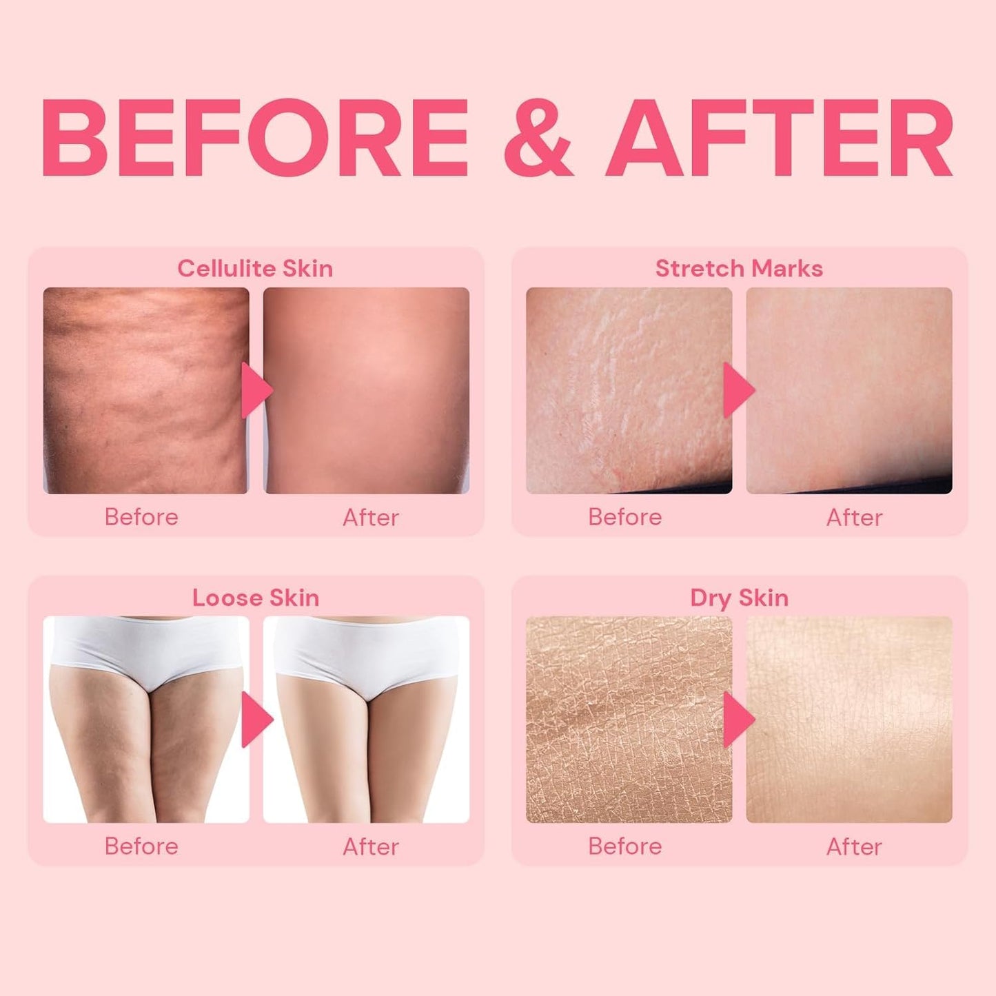 Enaskin Naturals Cellulite Remover for Legs & Anti Cellulite Cream - Skin Firming and Tightening Lotion for Inner Thigh ,Booty, Stomach & Belly, Body Firming Cream for Loose Skin, 100 ML