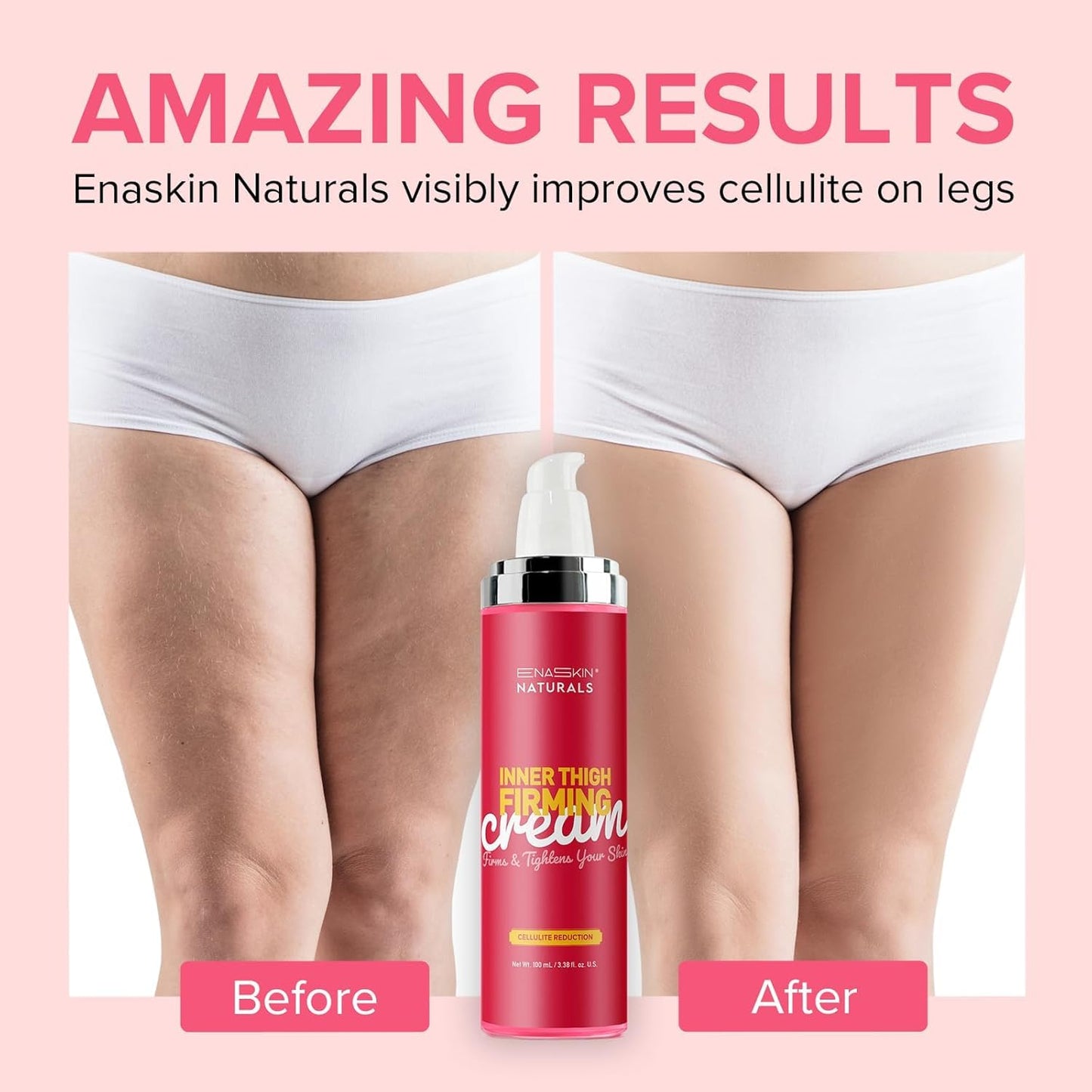 Anti Cellulite Body Firming Cream: Cellulite Remover for Legs & Inner Thigh- Skin Tightening Lotion for Womens' Booty, Stomach & Belly with Acetyl Hexapeptide-8 & Caffeine, 100 ML
